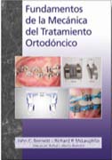 Fundamentos de la mecánica del tratamiento ortodoncico