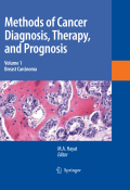 Methods of cancer diagnosis, therapy and prognosis: breast carcinoma