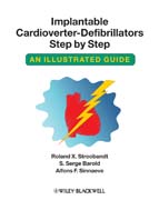 Implantable cardioverter-defibrillators step by step: an illustrated guide