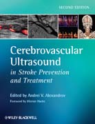 Cerebrovascular ultrasound in stroke prevention and treatment