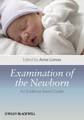 Examination of the newborn: an evidence based guide