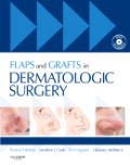 Flaps and grafts in dermatologic surgery