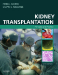 Kidney transplantation: principles and practice