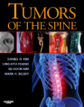 Tumors of the spine