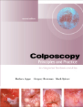 Colposcopy: principles and practice