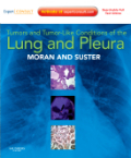 Tumors and tumor-like conditions of the lung and pleura: expert consult : online and print