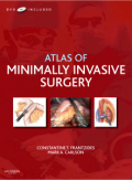 Atlas of minimally invasive surgery