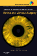 Retina and vitreous surgery