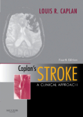 Caplan's stroke: a clinical approach