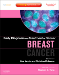 Breast cancer (expert consult : online and print)