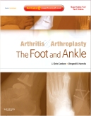 Arthritis and arthroplasty: the foot and ankle : expert consult