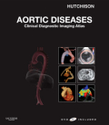 Aortic diseases: clinical diagnostic imaging atlas with dvd
