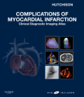 Complications of myocardial infarction: clinical diagnostic imaging atlas with dvd