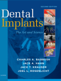 Dental implants: the art and science