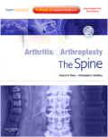 Arthritis and arthroplasty: the spine : expert consult