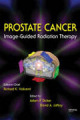 Prostate cancer: image-guided radiation therapy
