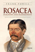 Rosacea: diagnosis and management