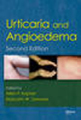 Urticaria and angioedema