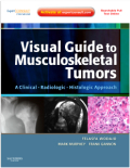 Visual guide to musculoskeletal tumors : expert consult - online and print: a clinical - radiologic - histologic approach