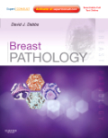 Breast pathology: expert consult - online and print