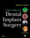 Color atlas of dental implant surgery