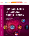 Cryoablation of cardiac arrhythmias: expert consult - online and print