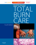 Total burn care: expert consult - online and print