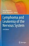 Lymphoma and leukemia of the nervous system