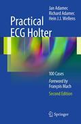 Practical ECG holter: 100 cases