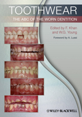 Toothwea: ABC of the worn dentition