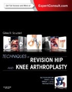 Techniques in Revision Hip and Knee Arthroplasty: Expert Consult: Online and Print