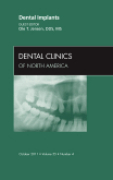 Dental implants: an issue of dental clinics