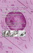 Liver transplantation: challenging controversies and topics