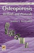 Osteoporosis: methods and protocols