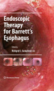 Endoscopic therapy for Barrett's esophagus