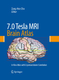 7.0 Tesla MRI brain atlas: in vivo atlas with cryomacrotome correlation