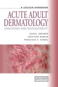 A colour handbook of acute adult dermatology
