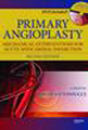 Primary angioplasty