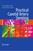 Carotid artery stenting: a practical guide