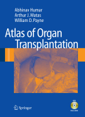 Atlas of organ transplantation