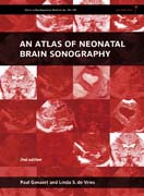 An atlas of neonatal brain sonography