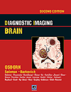 Diagnostic imaging: brain
