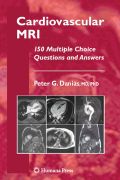 Cardiovascular MRI: 150 multiple-choice questions and answers