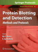 Protein blotting and detection: methods and protocols