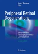 Peripheral Retinal Degenerations: Optical Coherence Tomography, Retinal Laser Coagulation: