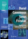 Dural cavernous sinus fistulas: diagnosis and endovascular therapy