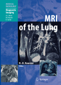 MRI of the lung