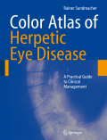 Color atlas of herpetic eye disease: a practical guide to clinical management