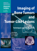 Imaging bone tumors and tumor-like lesions: techniques and applications