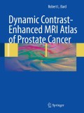 Dynamic contrast-enhanced MRI atlas of prostate cancer